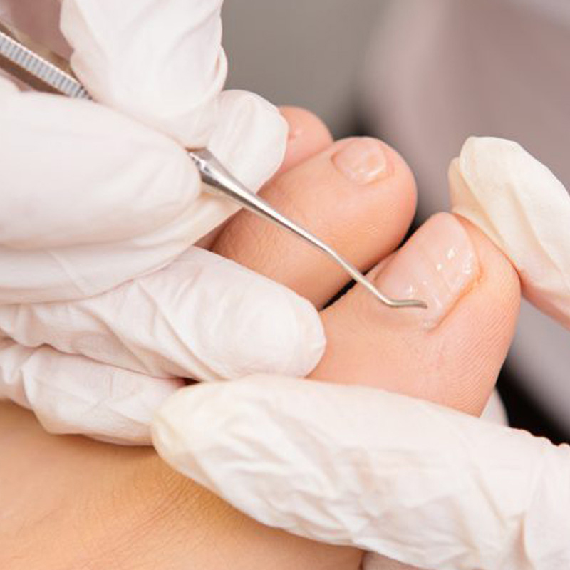 Pedicure Curativo Donna Pigmenta