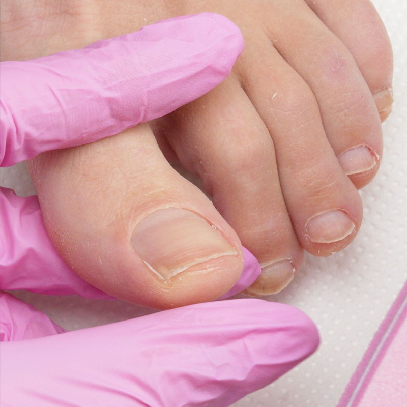 Pedicure Curativo Donna