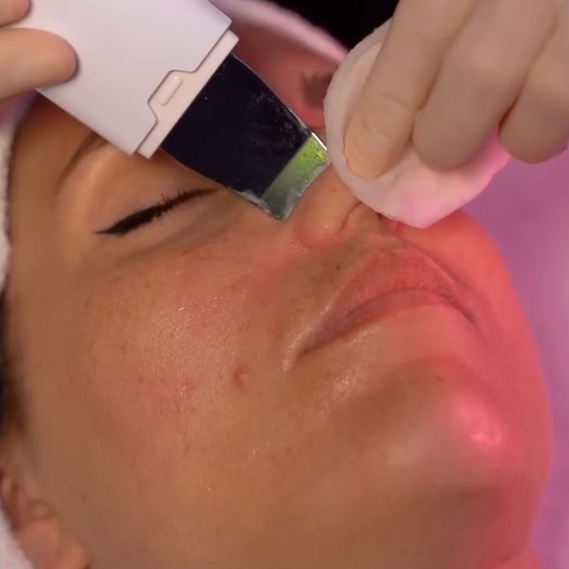 Pulizia viso ultraskin